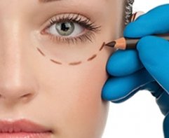 Blefaroplastia