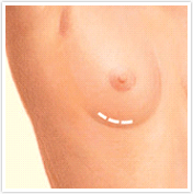 image039.png