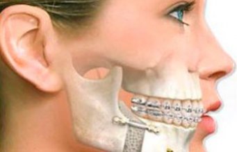 Dr. S�rgio Evangelista - Cirurgia Buco Maxiliar em Sorriso - Mato Grosso