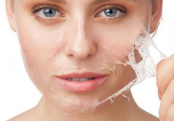 PEELING QU�MICO N�VEL M�DIO
